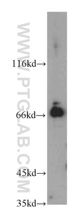 BTN2A1 Antibody in Western Blot (WB)