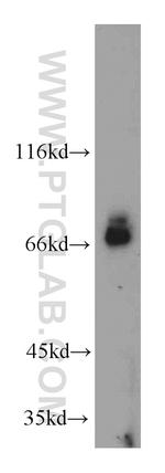 BTN2A1 Antibody in Western Blot (WB)