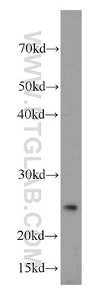 CD9 Antibody in Western Blot (WB)