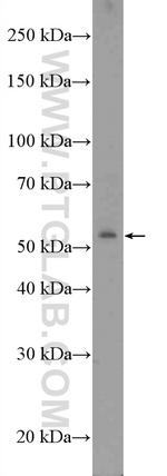 ZNF486 Antibody in Western Blot (WB)