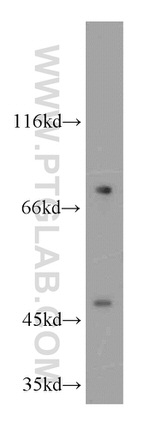 AGPAT9 Antibody in Western Blot (WB)
