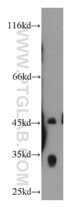CENPO Antibody in Western Blot (WB)