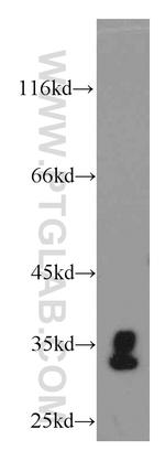 CENPO Antibody in Western Blot (WB)