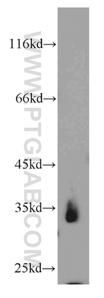 CENPO Antibody in Western Blot (WB)