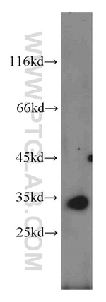CENPO Antibody in Western Blot (WB)