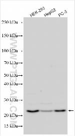 SLC25A40 Antibody in Western Blot (WB)
