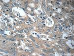 FAM83A Antibody in Immunohistochemistry (Paraffin) (IHC (P))