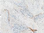 THSD4 Antibody in Immunohistochemistry (Paraffin) (IHC (P))