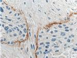 THSD4 Antibody in Immunohistochemistry (Paraffin) (IHC (P))