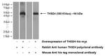 THSD4 Antibody in Western Blot (WB)