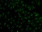GBA Antibody in Immunocytochemistry (ICC/IF)