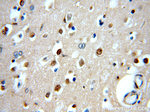 GBA Antibody in Immunohistochemistry (Paraffin) (IHC (P))