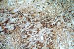 GBA Antibody in Immunohistochemistry (Paraffin) (IHC (P))
