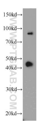 ABHD12B Antibody in Western Blot (WB)