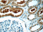ZIP4 Antibody in Immunohistochemistry (Paraffin) (IHC (P))