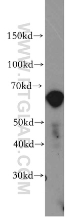 ZIP4 Antibody in Western Blot (WB)