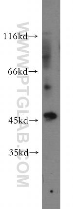SOX8 Antibody in Western Blot (WB)
