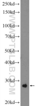 CPPED1 Antibody in Western Blot (WB)