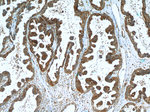 ROR1 Antibody in Immunohistochemistry (Paraffin) (IHC (P))