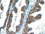 ROR1 Antibody in Immunohistochemistry (Paraffin) (IHC (P))