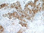 ROR1 Antibody in Immunohistochemistry (Paraffin) (IHC (P))