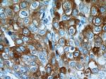 ROR1 Antibody in Immunohistochemistry (Paraffin) (IHC (P))
