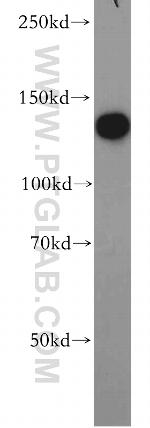 ROR1 Antibody in Western Blot (WB)