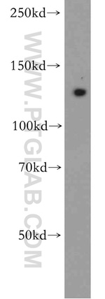 ROR1 Antibody in Western Blot (WB)