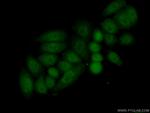 HOXC10 Antibody in Immunocytochemistry (ICC/IF)