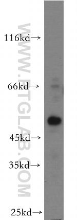 HOXC10 Antibody in Western Blot (WB)