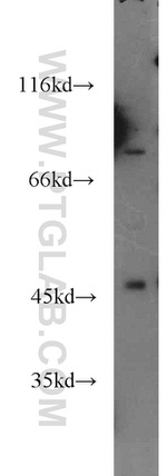 HOXC10 Antibody in Western Blot (WB)