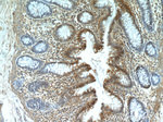 CXCR2 Antibody in Immunohistochemistry (Paraffin) (IHC (P))