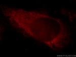 KIAA1191 Antibody in Immunocytochemistry (ICC/IF)