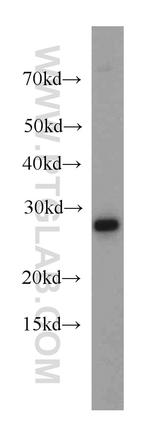 CHCHD6 Antibody in Western Blot (WB)