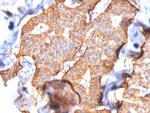 HER-2/c-erbB-2/neu/CD340 Antibody in Immunohistochemistry (Paraffin) (IHC (P))