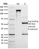 HER-2/c-erbB-2/neu/CD340 Antibody in SDS-PAGE (SDS-PAGE)