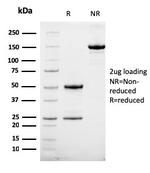 HER-2/c-erbB-2/neu/CD340 Antibody in SDS-PAGE (SDS-PAGE)