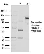 HER-2/c-erbB-2/neu/CD340 Antibody in SDS-PAGE (SDS-PAGE)