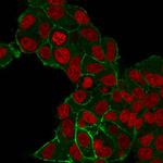 HER-2/c-erbB-2/neu/CD340 Monoclonal Antibody (HRB2/282)