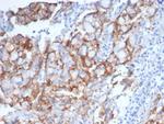HER-2/c-erbB-2/neu/CD340 Antibody in Immunohistochemistry (Paraffin) (IHC (P))