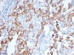 HER-2/c-erbB-2/neu/CD340 Antibody in Immunohistochemistry (Paraffin) (IHC (P))