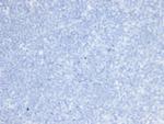 HER-2/c-erbB-2/neu/CD340 Antibody in Immunohistochemistry (Paraffin) (IHC (P))