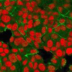 HER-2/c-erbB-2/neu/CD340 Monoclonal Antibody (HRB2/718)