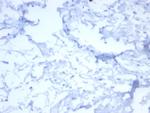 HER-2/c-erbB-2/neu/CD340 Antibody in Immunohistochemistry (Paraffin) (IHC (P))