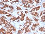 HER-2/c-erbB-2/neu/CD340 Antibody in Immunohistochemistry (Paraffin) (IHC (P))