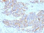 HER-2/c-erbB-2/neu/CD340 Antibody in Immunohistochemistry (Paraffin) (IHC (P))