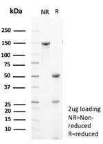 HER-2/c-erbB-2/neu/CD340 Antibody in SDS-PAGE (SDS-PAGE)