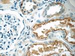 HERPUD2 Antibody in Immunohistochemistry (Paraffin) (IHC (P))