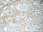 HERPUD2 Antibody in Immunohistochemistry (Paraffin) (IHC (P))
