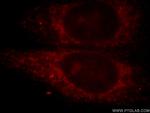 PTPIP51 Antibody in Immunocytochemistry (ICC/IF)